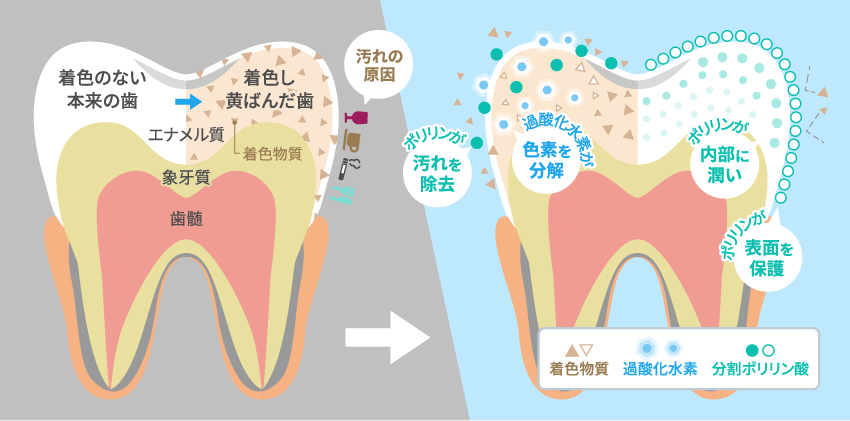 ミュゼホワイトニング 診療案内 山元歯科医院